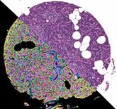 Foto: Un nuevo atlas celular del páncreas humano revela cómo se adapta a las enfermedades