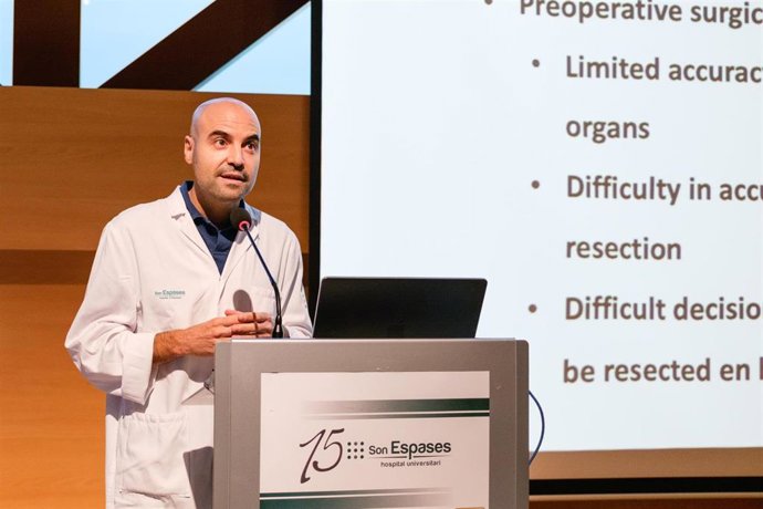 Son Espases mejora el índice de supervivencia del cáncer colorrectal avanzado con un planificador quirúrgico pionero.