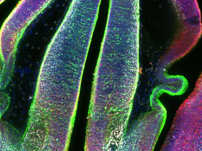 Imagen del tálamo embrionario del ratón que muestra (verde fluorescente) las células progenitoras y su descendencia