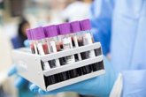 Foto: Los modelos de aprendizaje automático podrían ayudar a identificar a personas con mayor riesgo de desarrollar cáncer