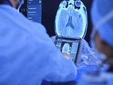 Foto: COMUNICADO: Un estudio impulsado por Philips supera los 320 pacientes para evaluar nuevas vías de atención al ictus