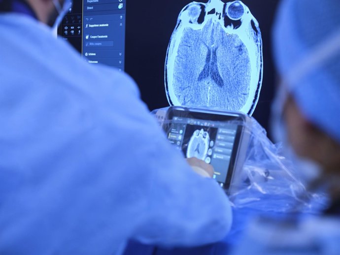 Archivo - Un estudio impulsado por Philips supera los 320 pacientes incluidos para evaluar vías de atención al ictus