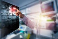 Prevenir el ictus en jóvenes: es clave vigilar la tensión y el colesterol