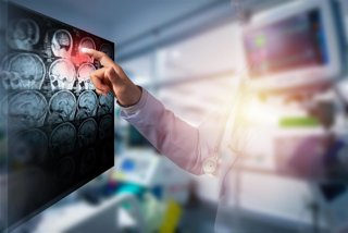 Archivo - Image de recurso de un doctor examinando un cerebro.