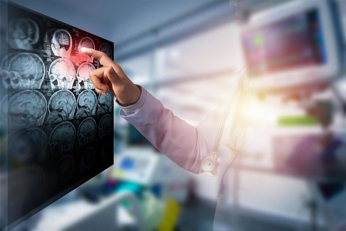 Archivo - Image de recurso de un doctor examinando un cerebro.